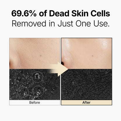 MANYO Galactomy Enzyme Peeling Gel